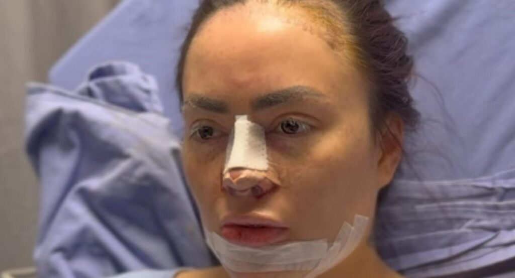 A ‘Epa Colombia’ le descubrieron peligroso objeto en su rostro; caucho de zapato