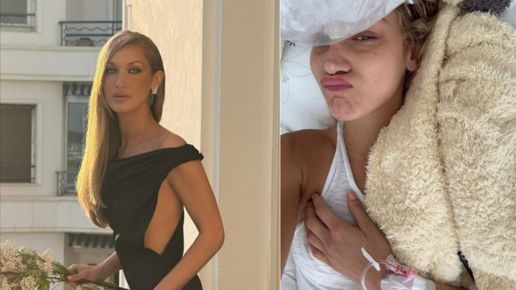 Bella Hadid en el hospital: la cruda realidad de su lucha contra la enfermedad de Lyme